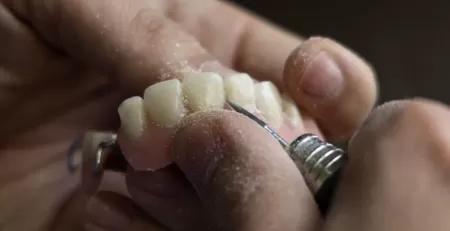 How to fix Broken Dentures
