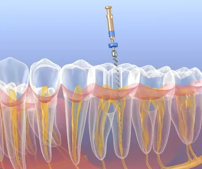 What procedures do Endodontists perform