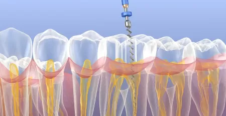 What procedures do Endodontists perform