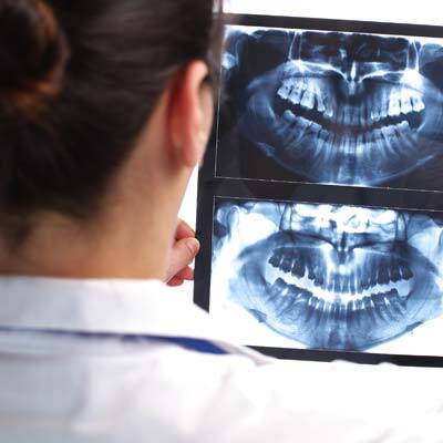 Dental X-Rays